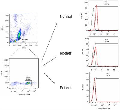 Distinct Clinical Features and Novel Mutations in Taiwanese Patients With X-Linked Agammaglobulinemia